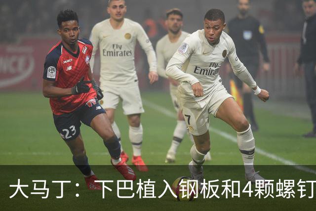 大马丁：下巴植入钢板和4颗螺钉，现在只能吃流食